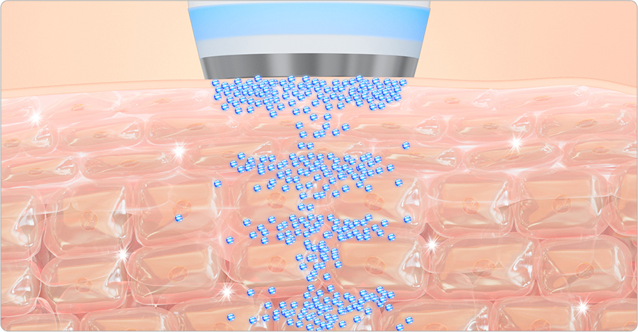 EL（エレクトロポレーション）