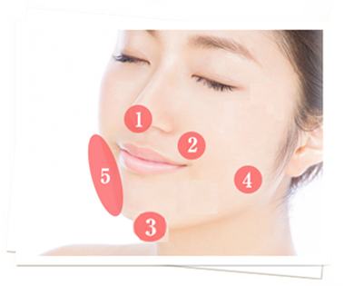 脂肪溶解注射の適応部位