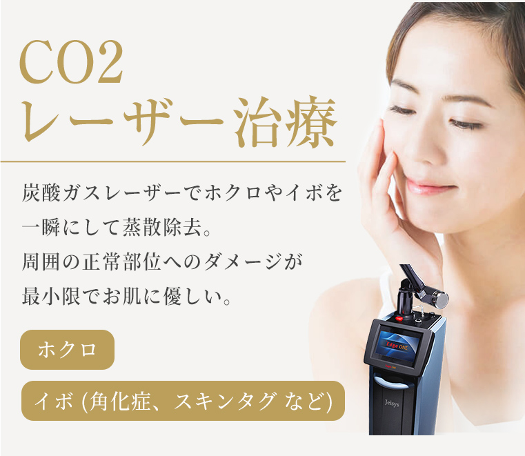 CO2レーザー