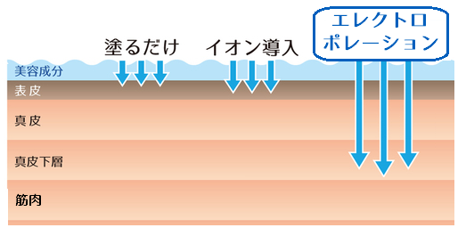 エレクトロポレーション