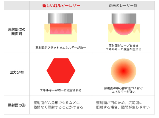 Qスイッチルビーレーザーの効果と特徴